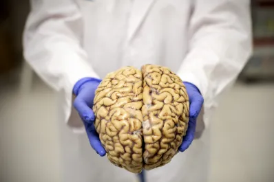 Siete hábitos clave para prevenir el alzheimer, incluso si hay antecedentes familiares