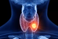 ¿Tenés problemas de tiroides? Los signos clave para saber si es hipo o hipertiroidismo