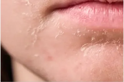 Deshidratación: cinco señales tempranas que no debes ignorar, en adultos mayores y en niños