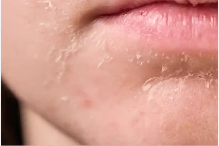 En sus estadíos más extremos, la deshidratación puede complicar diversos órganos.