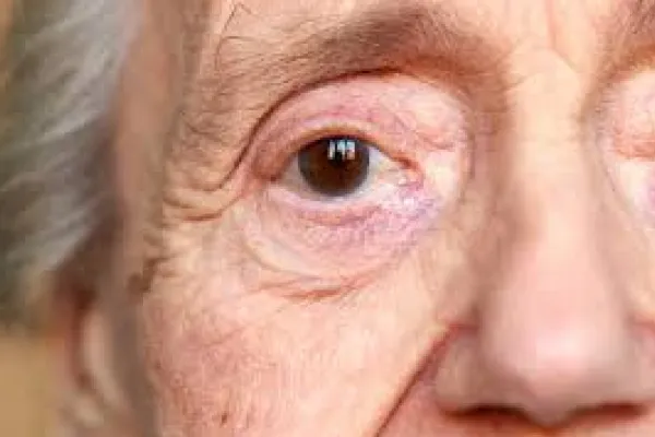 Los ojos pueden alertar sobre la demencia.