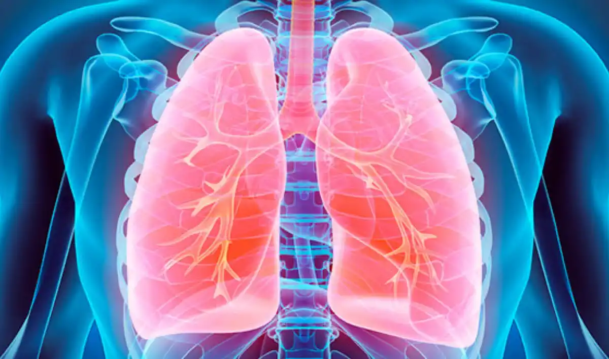 El asma puede predisponer a otros tipos de cáncer.