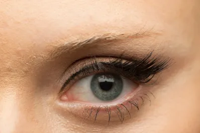 Colesterol alto: señales en los ojos que podrían indicar un problema cardiovascular