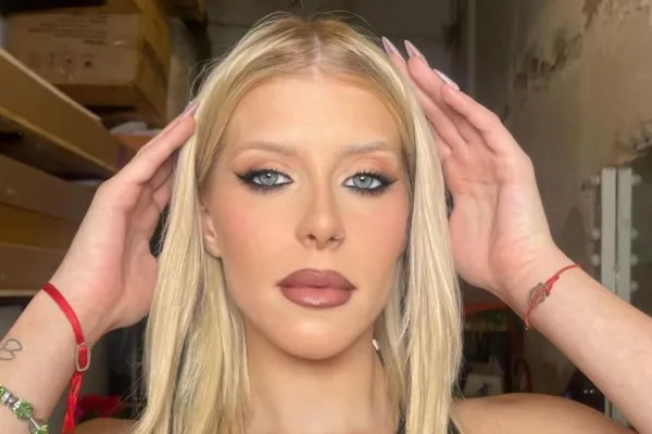 La ex Gran Hermano Camila Lattanzio sufrió un fuerte accidente: Venía de un after