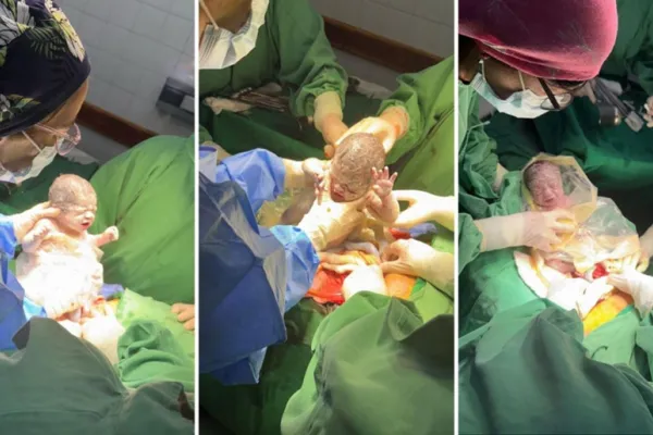 Nacieron trigemelos en Salta: la increíble historia detrás de este inusual nacimiento