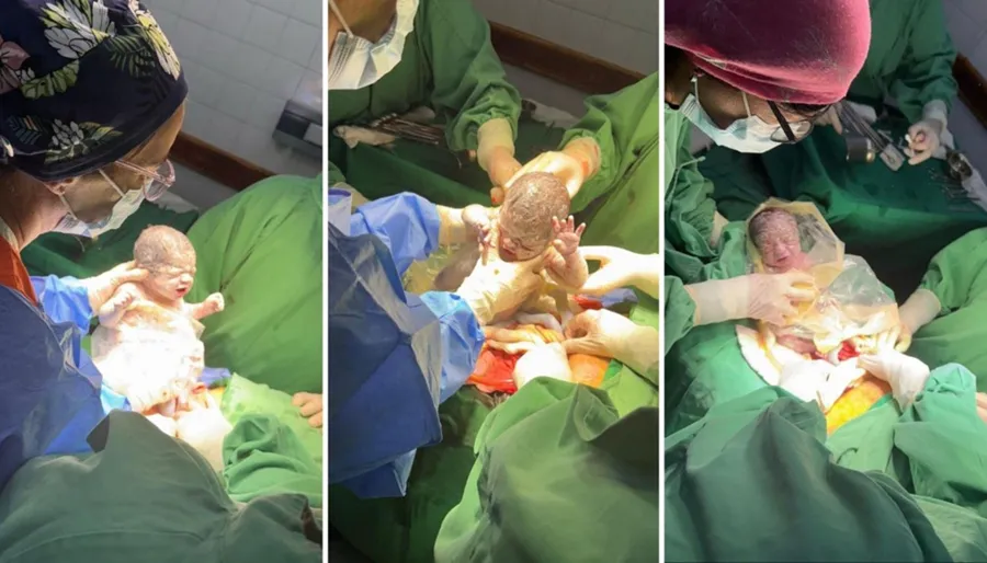 Nacieron trigemelos en Salta: un caso poco frecuente que ocurre en 1 de cada 6.400 embarazos