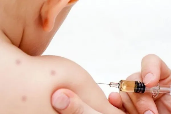 Único caso de sarampión en los últimos 10 días: estas son las recomendaciones del Ministerio de Salud