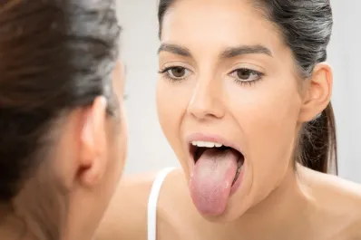 La sutil molestia en la boca que puede indicar niveles altos de azúcar en sangre