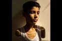 La imagen de un niño mutilado en un ataque en Gaza es la foto del año del World Press Photo