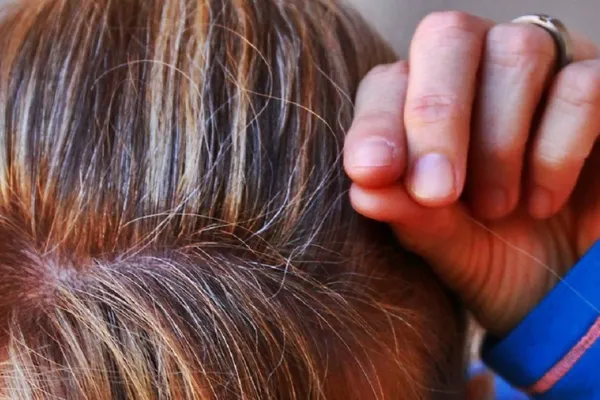 Es verdad que si te sacás una cana aparecen tres? Lo que dice la