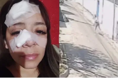 Una mujer se negó a darles comida a dos personas y le fracturaron la nariz con una piedra