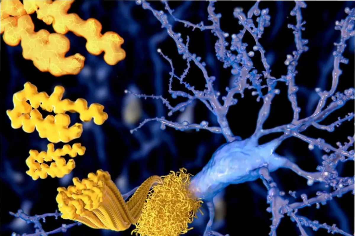 Un joven oriundo de Pekín recibió el diagnóstico de Alzheimer a sus 17 años. 