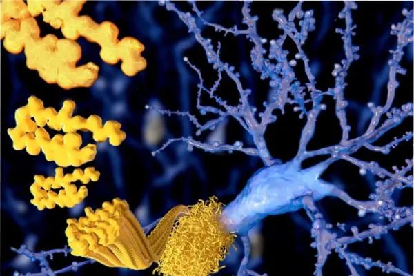 Cuál es el ejercicio simple que recomienda Harvard para reducir el riesgo de demencia y Alzheimer