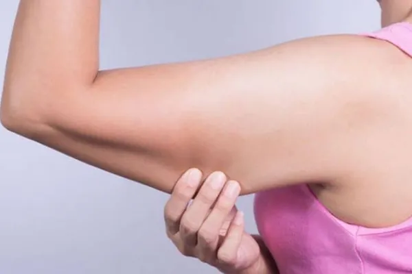 Ejercicios para los tríceps: cómo eliminar las alas de murciélago de forma efectiva