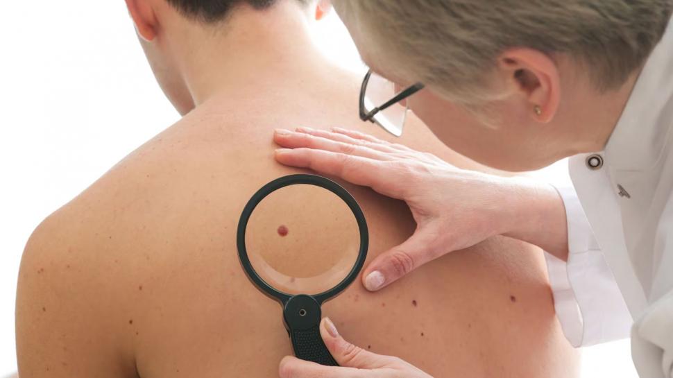 JÓVENES. El diagnóstico de cáncer ha aumentado en el último tiempo.