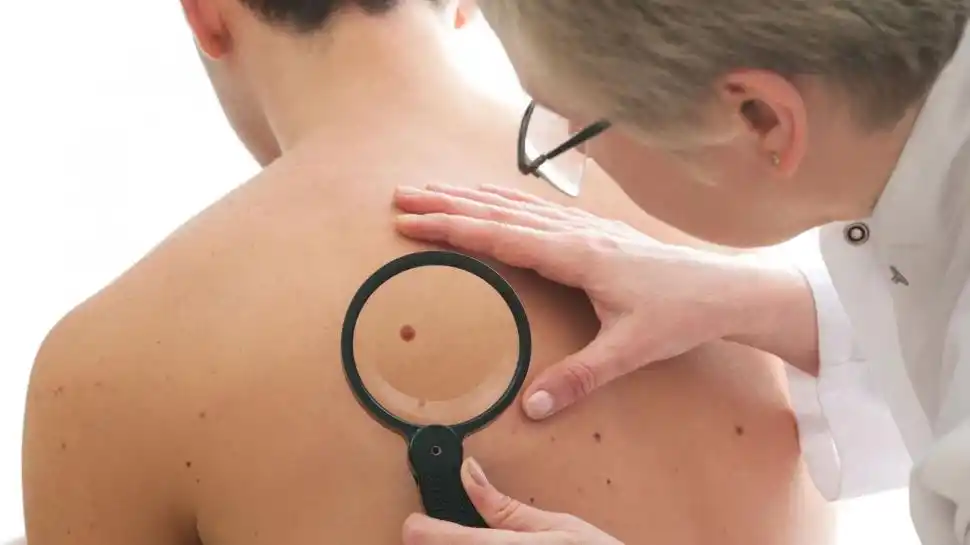 JÓVENES. El diagnóstico de cáncer ha aumentado en el último tiempo.