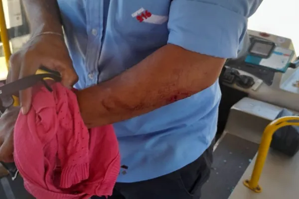 Detienen a un joven que golpeó a su mamá con una llave cruz en la cabeza