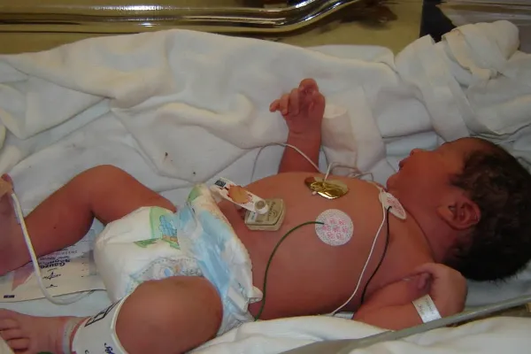 Enfermedades respiratorias en niños: 2025 pinta como un año crítico