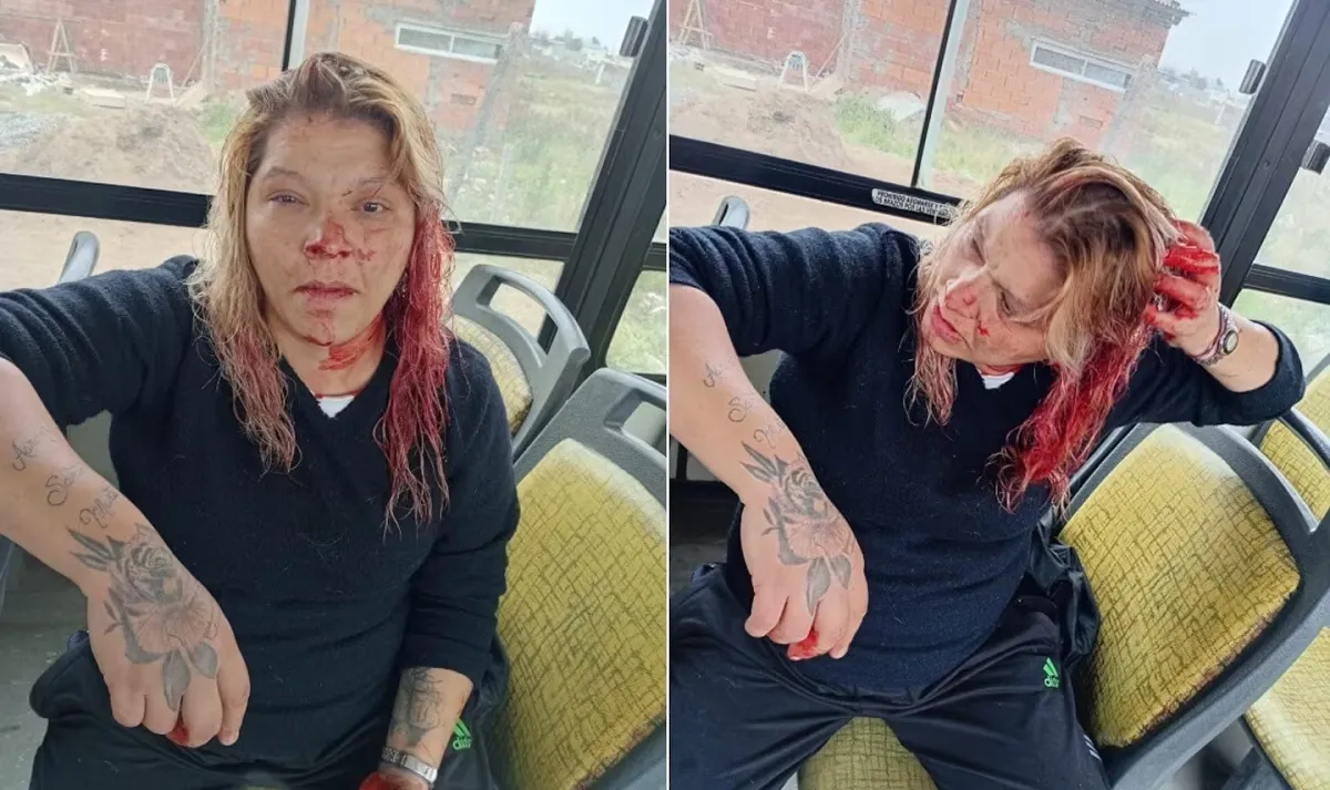Mayra Coronel, tras el ataque que sufrió en el colectivo. (Foto: gentileza La Brújula 24).