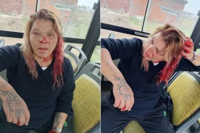 La golpearon con un caño en el colectivo por no invitar a las chicas del barrio a la fiesta de 15 de su hija