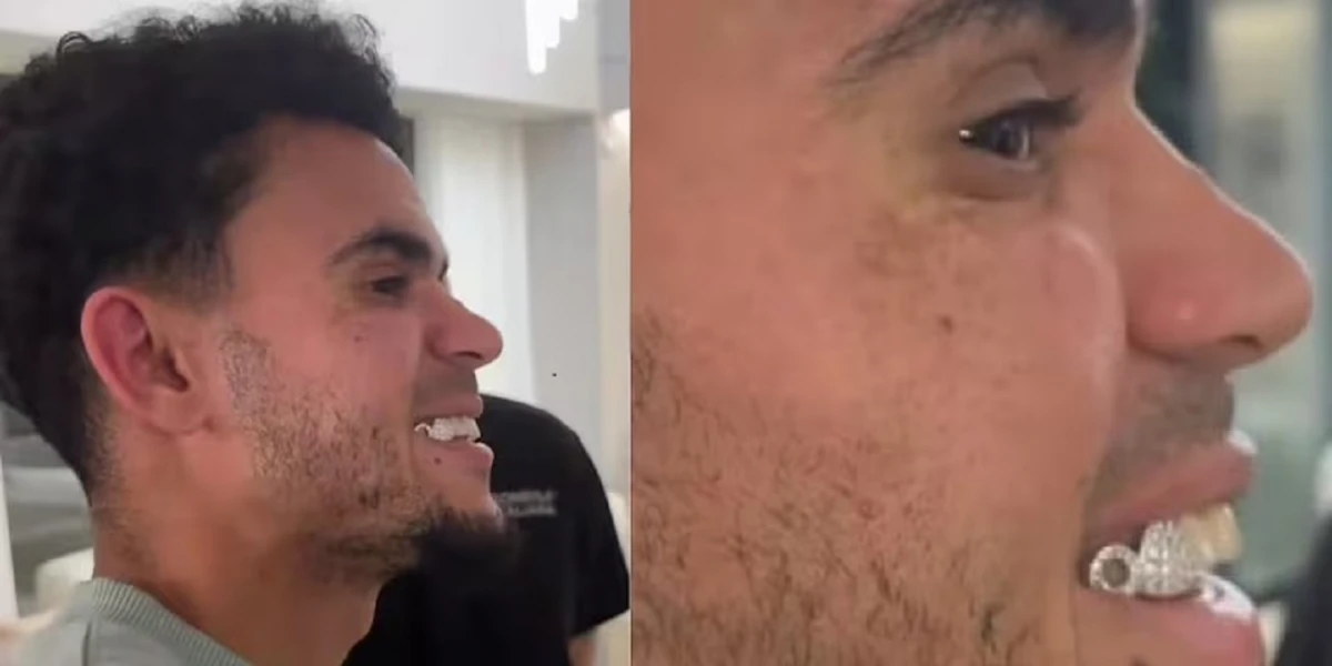 Una sonrisa más que brillante: Díaz se incrustó joyas en su dentadura antes de casarse