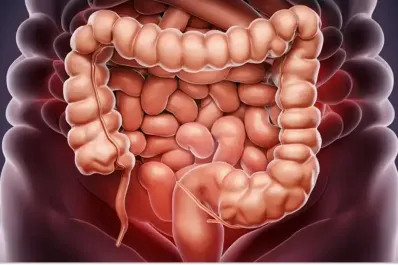 Cáncer colorrectal: Argentina cuenta con los índices más altos de la región y podría estar relacionado con la dieta