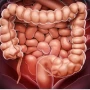 Cáncer colorrectal: Argentina cuenta con los índices más altos de la región y podría estar relacionado con la dieta