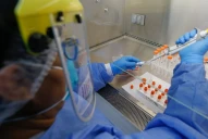 La OMS clasificó a Nimbus como una variante bajo monitoreo del Covid-19: cuáles son los síntomas