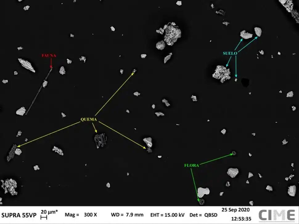 ASÍ SE VEN EN EL MICROSCOPIO. En la imagen queda precisado el origen de cada una de ellas. Los tamaños varían en todos los casos.