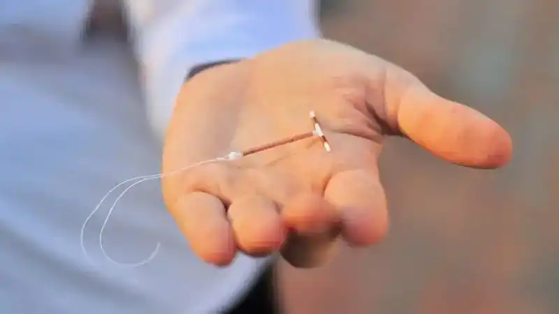 Anticonceptivos: ganan terreno los métodos de larga duración