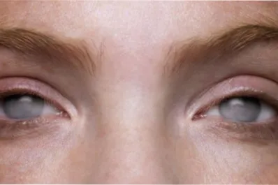 Sustitución sensorial: cómo el cerebro aprende a “ver” sin ojos tras la ceguera