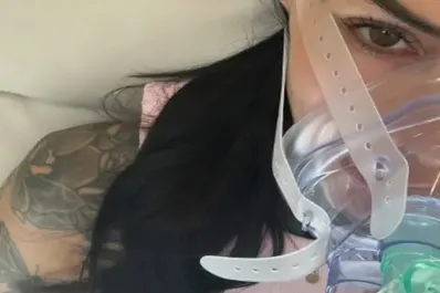 Hipoxia: de qué se trata la terapia que promociona Cande Tinelli