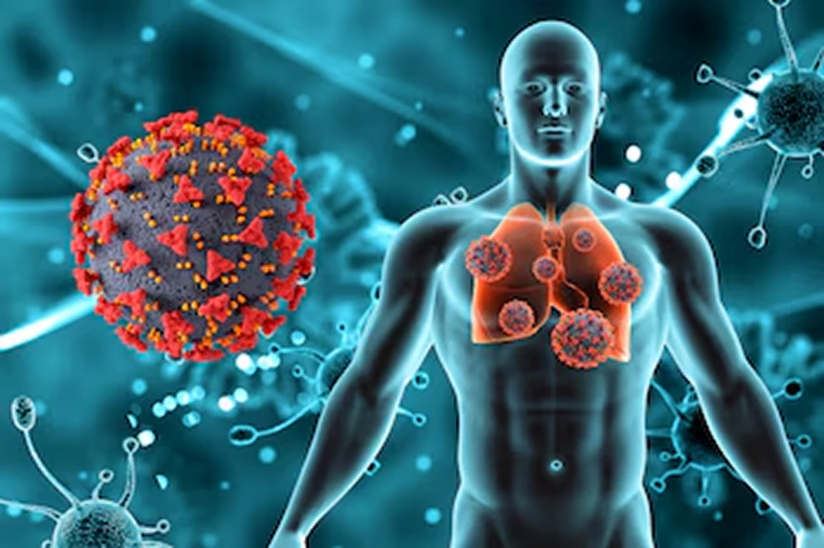 La nueva cepa de COVID llamada Frankenstein: ¿cuáles son sus síntomas?