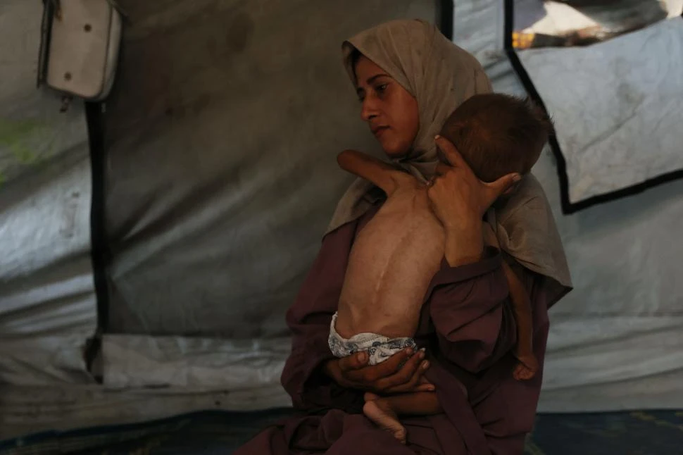 “INHUMANO”. Los casos de desnutrición severa en menores de cinco años se triplicaron en los últimos 14 días. 