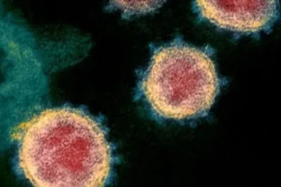 Variante de Covid Frankenstein: ¿cómo identificar los síntomas?