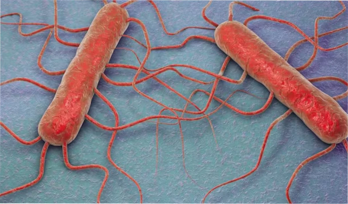 ¿Qué es la listeriosis y a quiénes afecta?