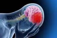 Los cinco síntomas que podrían indicar un ACV y nunca deben subestimarse, según un neurólogo