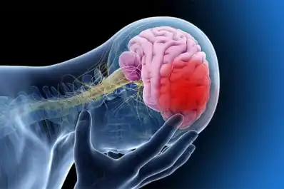 Día Mundial del ACV: señales de alerta y cómo reaccionar ante un ataque cerebrovascular