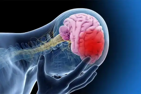 Día Mundial del ACV: señales de alerta y cómo reaccionar ante un ataque cerebrovascular