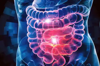 Una investigación revela qué forma de ejercitarse puede proteger contra un cáncer muy común