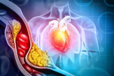 Colesterol: seis mitos peligrosos que podrían estar dañando tu salud