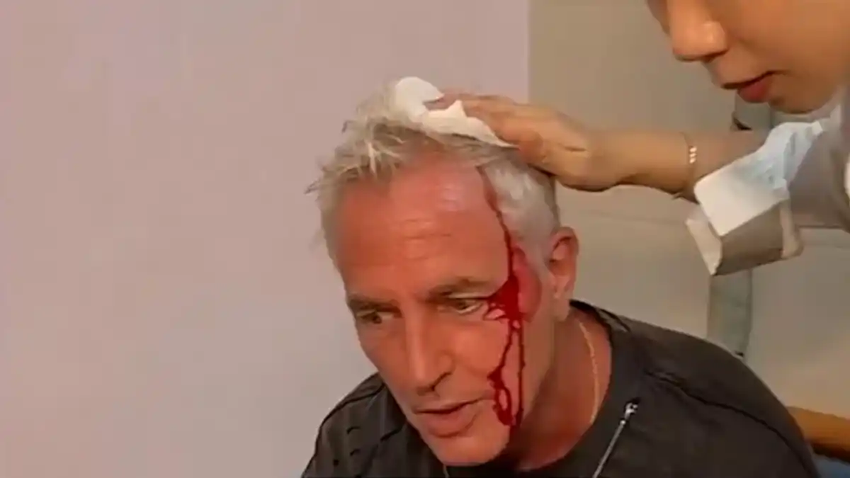 Marley sufrió un grave accidente en Tailandia durante la grabación de Por el Mundo