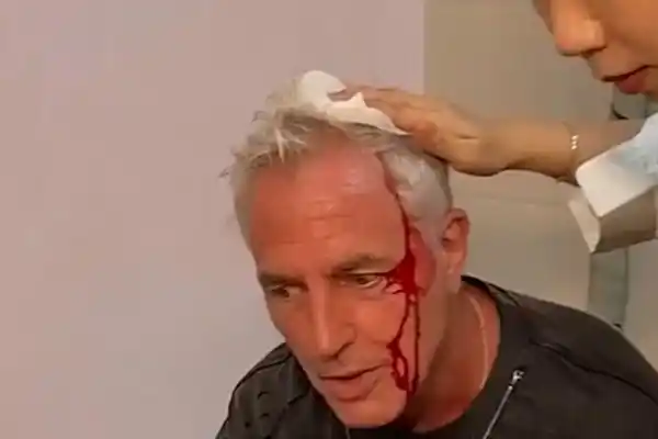 Marley sufrió un grave accidente en Tailandia durante la grabación de Por el Mundo