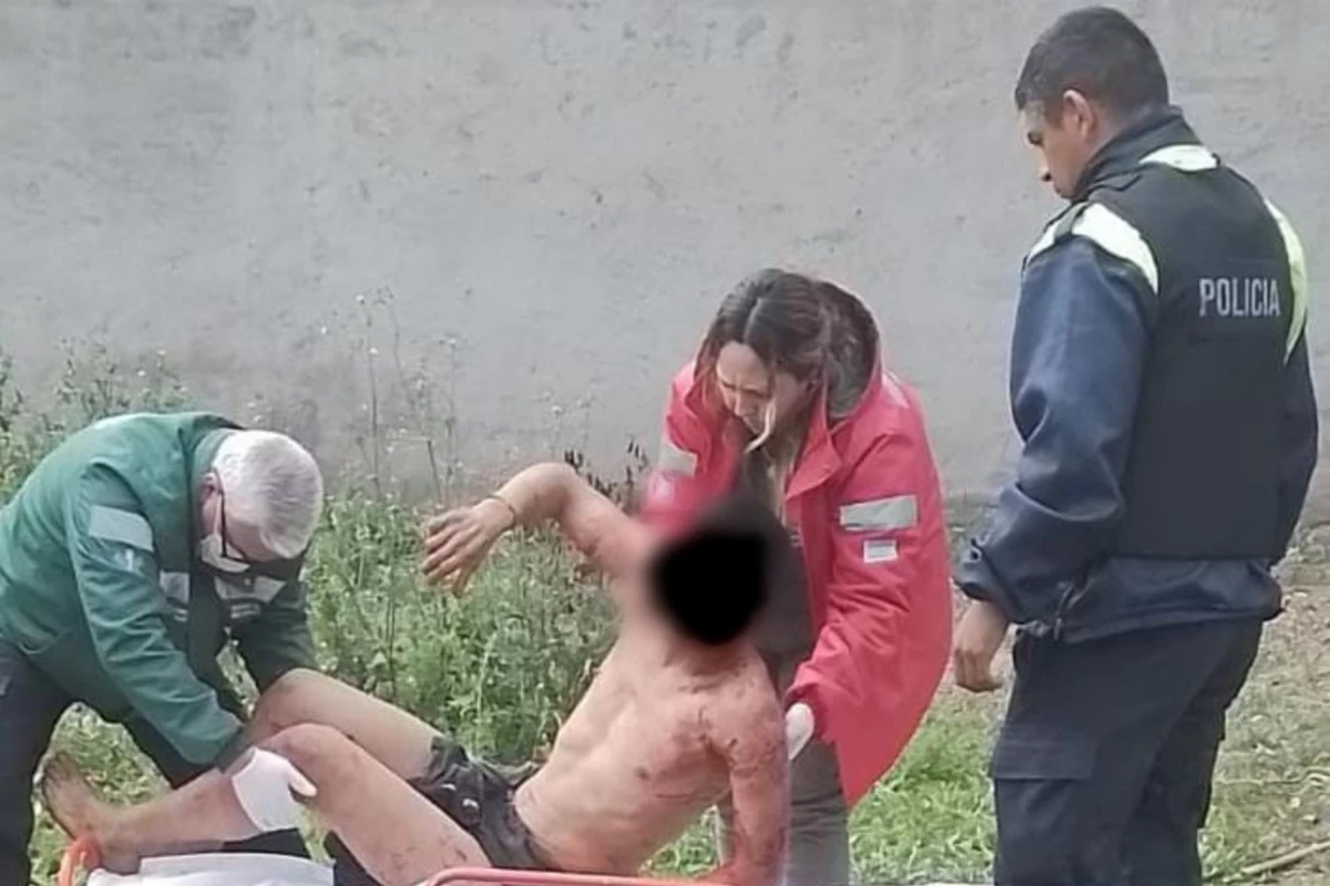 Un joven fue atacado por una jauría tras trepar la tapia de su vecina en Yerba Buena