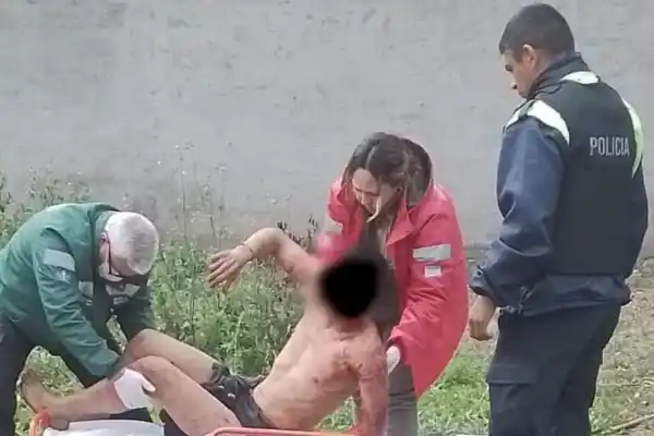 Un joven fue atacado por una jauría tras trepar la tapia de su vecina en Yerba Buena