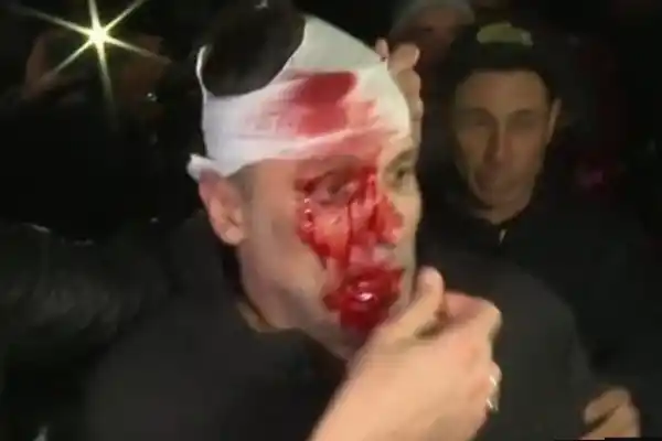 Incidentes en el acto de Milei en Moreno: a un periodista le dieron un botellazo en la cabeza