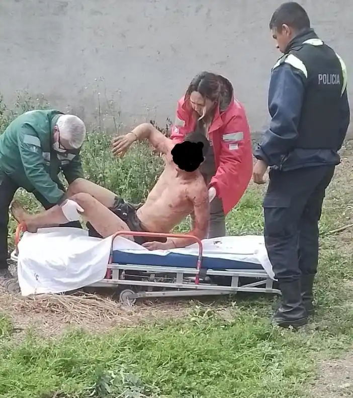 AYUDA. El joven atacado por los perros fue trasladado en ambulancia.