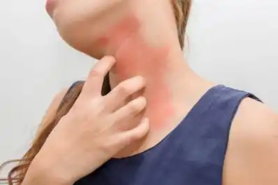 Más que una simple alergia: qué es la anafilaxia y cómo afecta