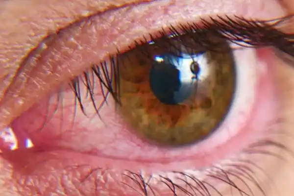 El ojo seco, un problema cada vez más frecuente: ¿cuándo se debe consultar a un especialista?