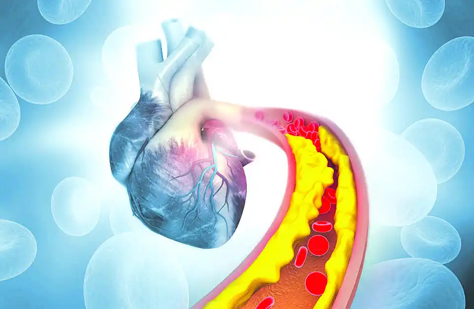 El colesterol es la primera causa de muerte mundial